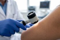 Medical professional examining skin with dermatoscope during clinical skin cancer screening